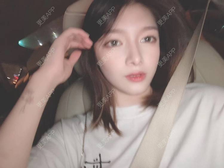 更美 - 直播听众朋友的鼻部多项经验 | 成都 | 视频日记 | 鼻部多项