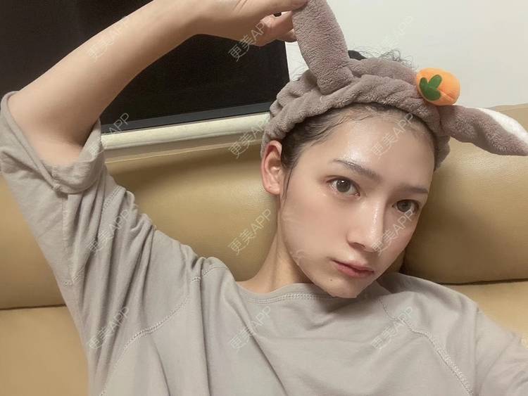 更美 - 直播听众朋友的鼻部多项经验 | 成都 | 视频日记 | 鼻部多项