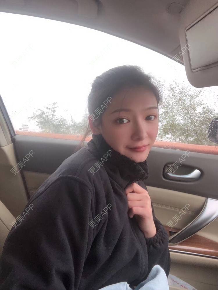 更美 - 直播听众朋友的鼻部多项经验 | 成都 | 视频日记 | 鼻部多项