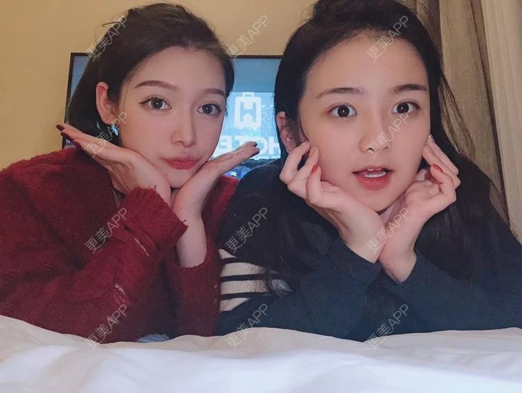 更美 - 直播听众朋友的鼻部多项经验 | 成都 | 视频日记 | 鼻部多项