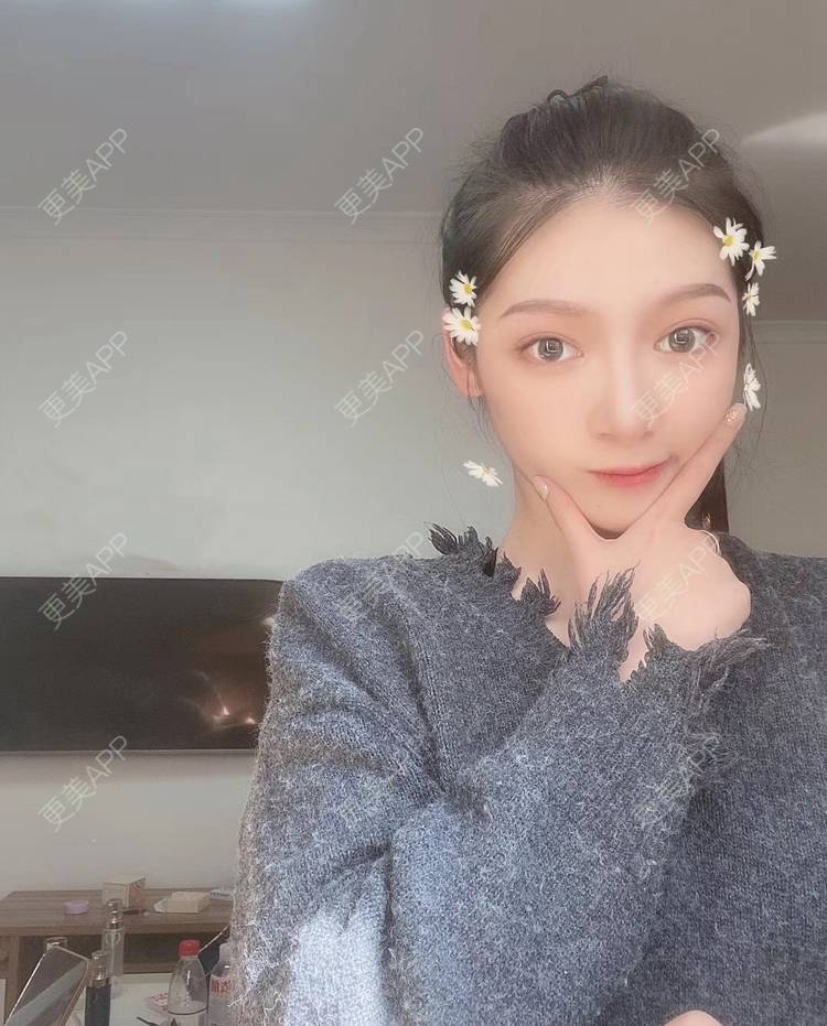 更美 - 直播听众朋友的鼻部多项经验 | 成都 | 视频日记 | 鼻部多项