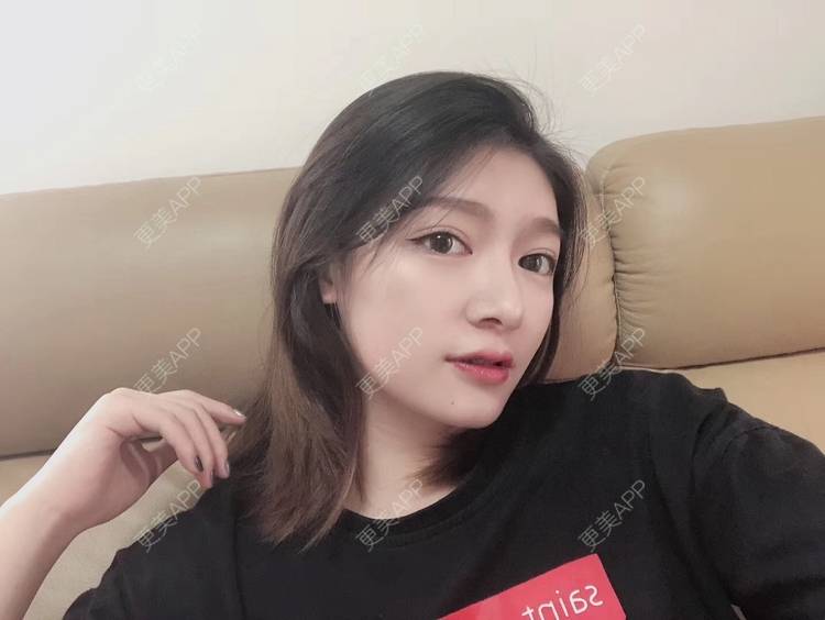 更美 - 直播听众朋友的鼻部多项经验 | 成都 | 视频日记 | 鼻部多项