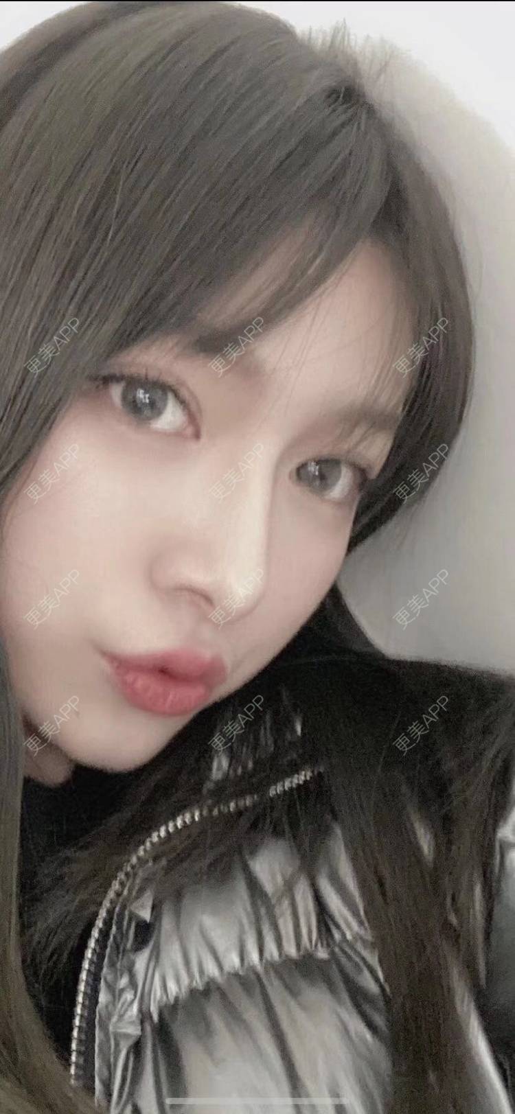 更美 - 直播听众朋友的鼻部多项经验 | 成都 | 视频日记 | 鼻部多项