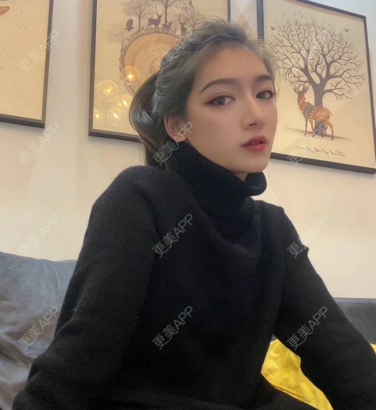 更美 - 直播听众朋友的鼻部多项经验 | 成都 | 视频日记 | 鼻部多项