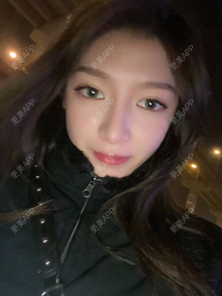 更美 - 直播听众朋友的鼻部多项经验 | 成都 | 视频日记 | 鼻部多项