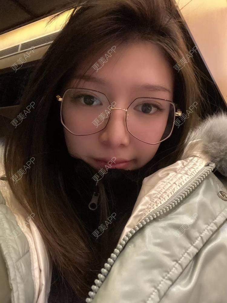 更美 - 直播听众朋友的鼻部多项经验 | 成都 | 视频日记 | 鼻部多项
