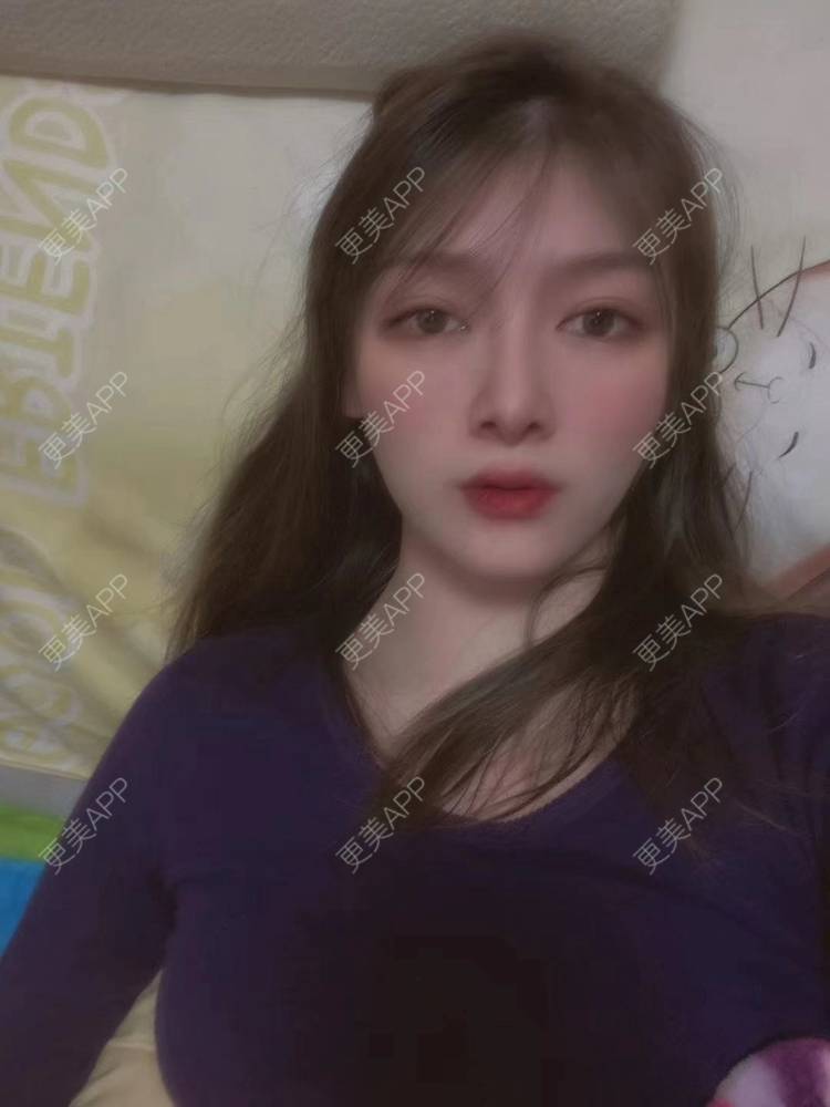 更美 - 直播听众朋友的鼻部多项经验 | 成都 | 视频日记 | 鼻部多项