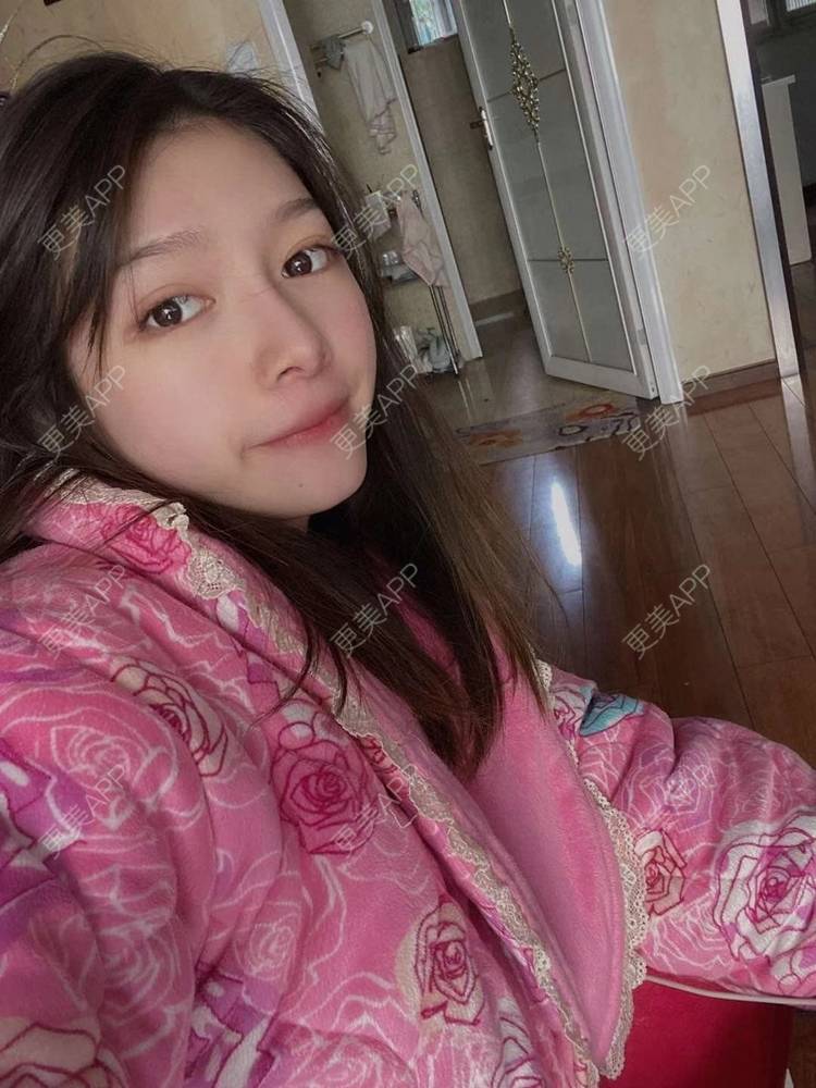 更美 - 直播听众朋友的鼻部多项经验 | 成都 | 视频日记 | 鼻部多项