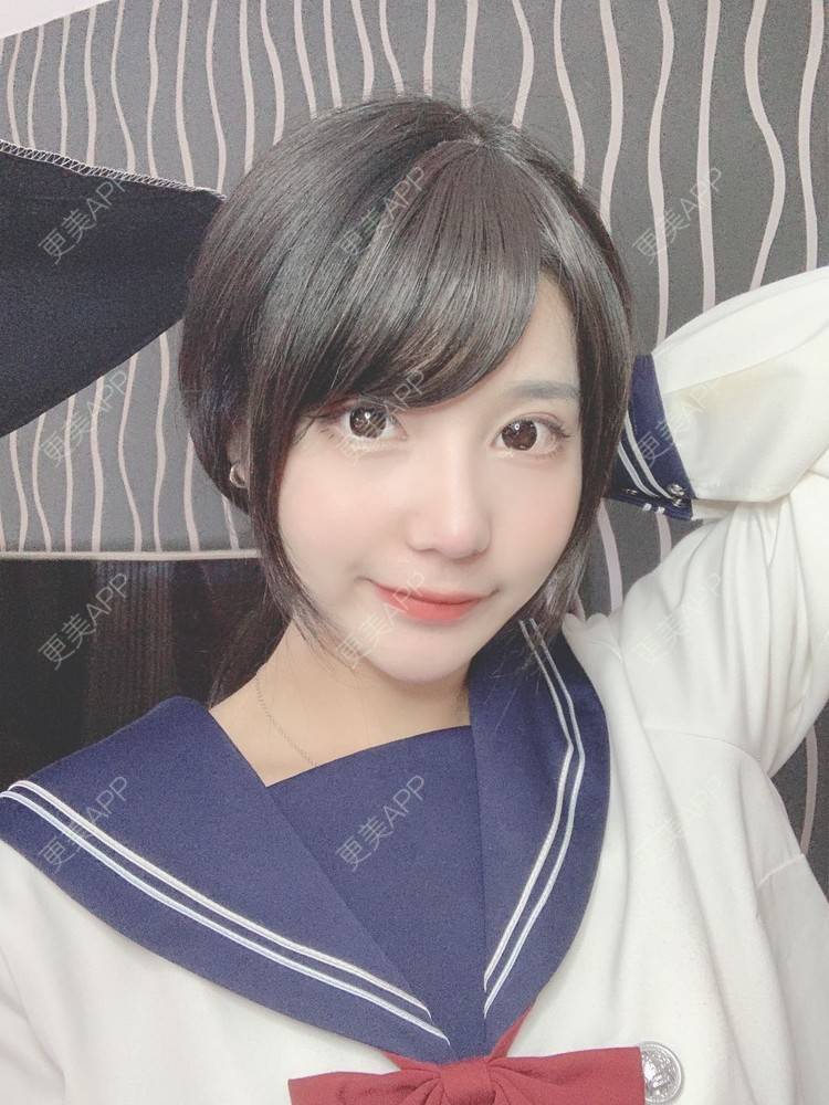 更美 - 尼卡挖土豆的鼻部修复经验 | 鼻部膨体假体取出 | 鼻形态修复 | 鼻部硅胶假体取出 | 鼻部多项 | 鼻小柱延长 | 鼻部修复 | 肋软骨隆鼻 | 玻尿酸鼻基底 | 鼻中隔软骨隆鼻 | 耳软骨隆鼻 | 自体肋软骨垫鼻基底