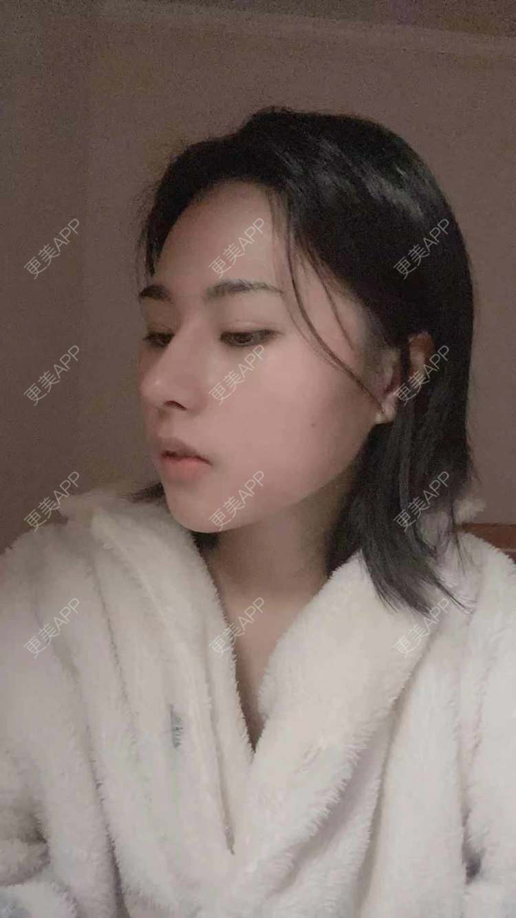 更美 - ヌ酷还可爱ˇ男的鼻部多项经验 | 鼻部多项 | 重庆