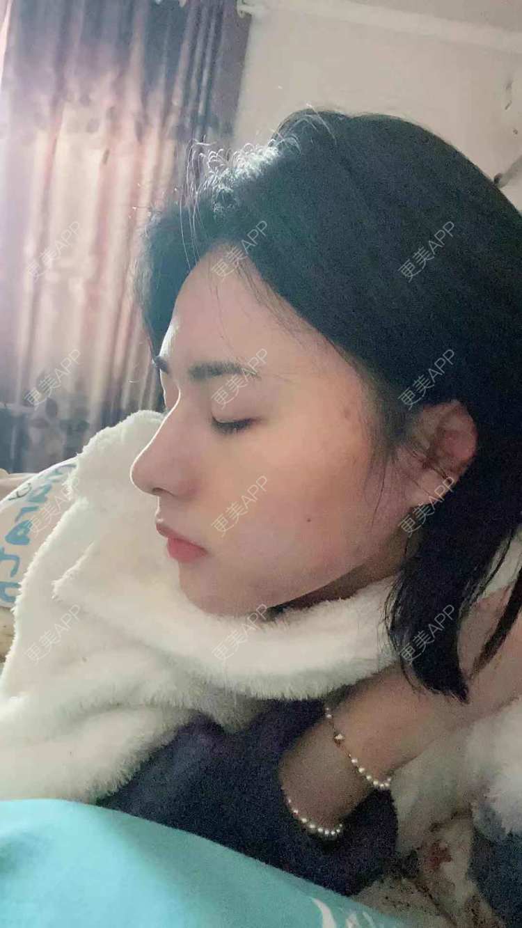 更美 - ヌ酷还可爱ˇ男的鼻部多项经验 | 鼻部多项 | 重庆
