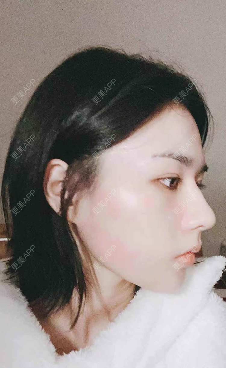 更美 - ヌ酷还可爱ˇ男的鼻部多项经验 | 鼻部多项 | 重庆