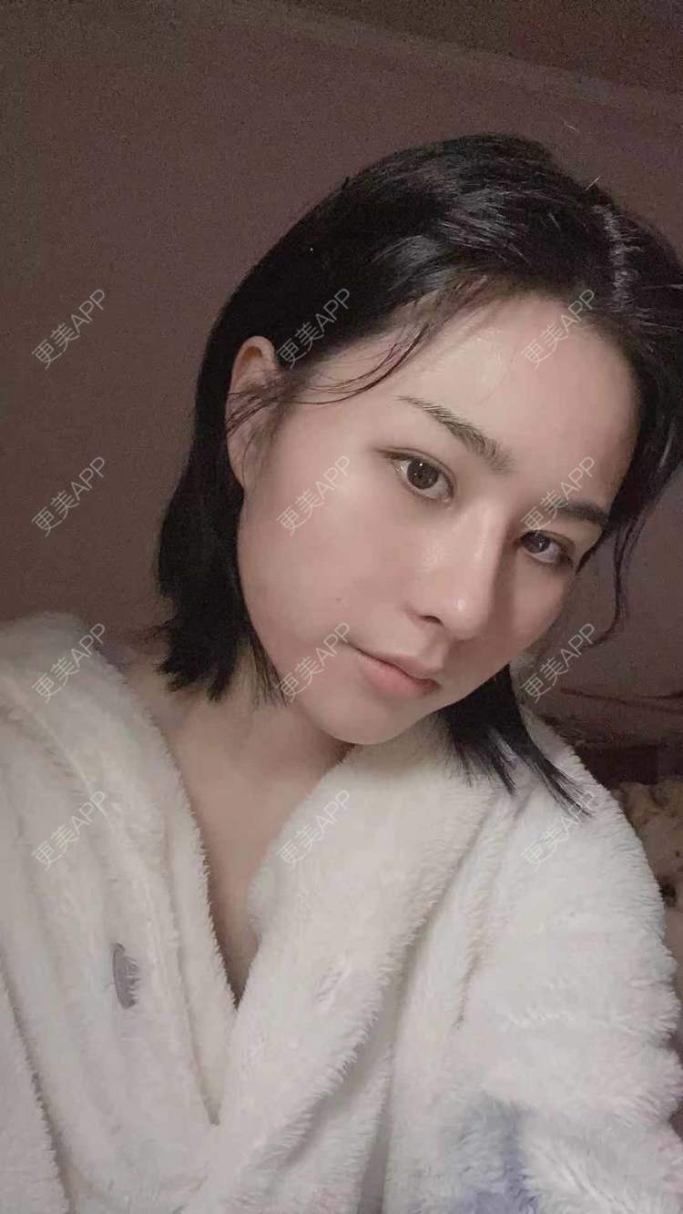 更美 - ヌ酷还可爱ˇ男的鼻部多项经验 | 鼻部多项 | 重庆