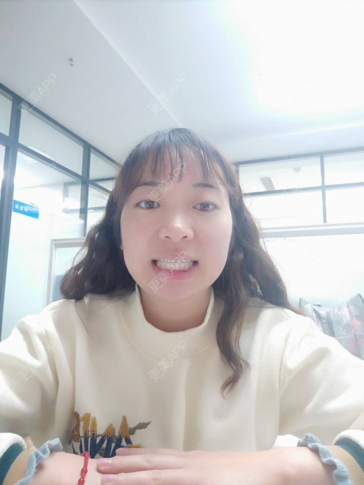 更美 - 橙子Jiang的牙齿矫正经验 | 牙齿矫正 | 成都