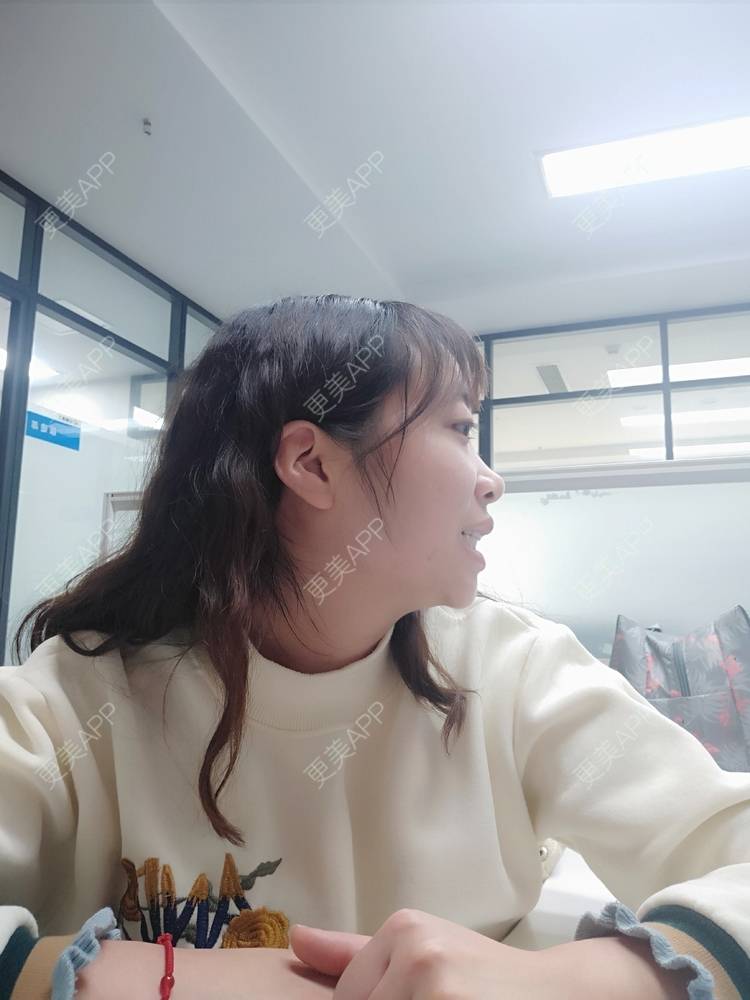 更美 - 橙子Jiang的牙齿矫正经验 | 牙齿矫正 | 成都