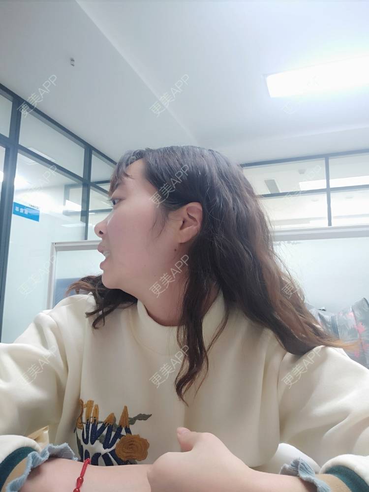更美 - 橙子Jiang的牙齿矫正经验 | 牙齿矫正 | 成都
