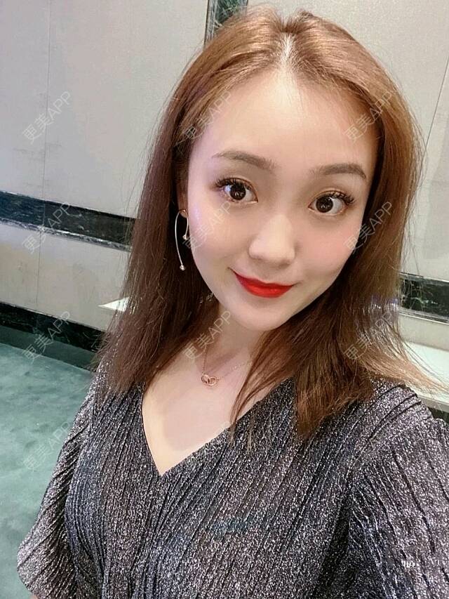 更美 - 更美用户LjS6ZAaKFX的玻尿酸颈纹经验 | 玻尿酸颈纹 | 广州