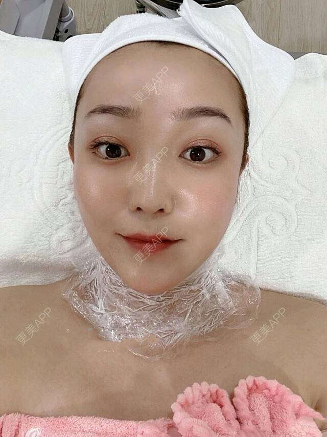 更美 - 更美用户LjS6ZAaKFX的玻尿酸颈纹经验 | 玻尿酸颈纹 | 广州