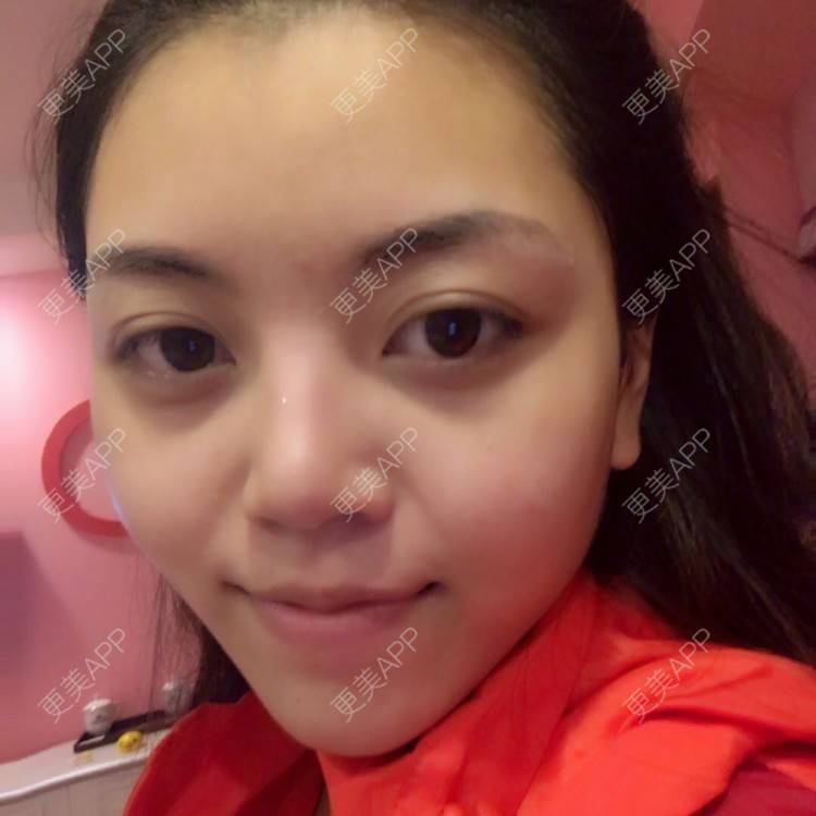 更美 - 一条狗的使命的鼻部多项经验 | 鼻部多项 | 重庆