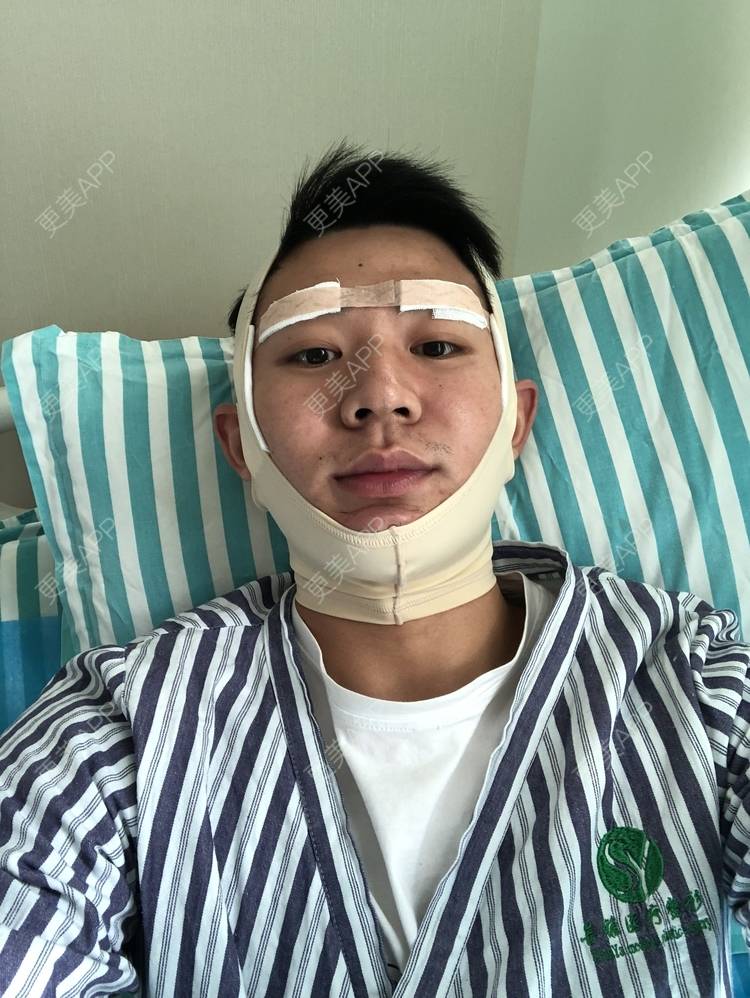更美 - 更美用户TaS3Qf994E的硅胶垫眉弓经验 | 硅胶垫眉弓