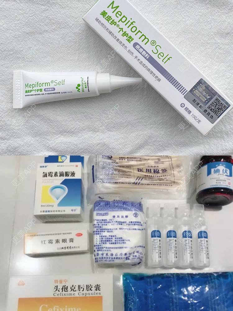 更美 - 更美用户nP6y0yD0GW的全切双眼皮经验 | 全切双眼皮 | 杭州