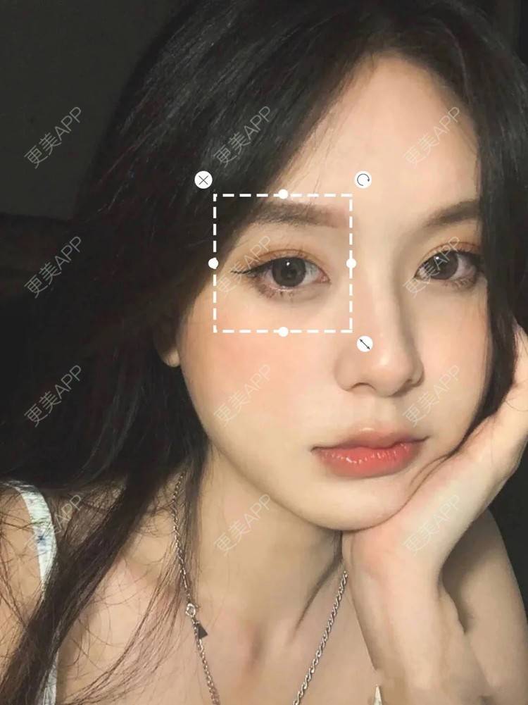 更美 - 更美用户nP6y0yD0GW的全切双眼皮经验 | 全切双眼皮 | 杭州