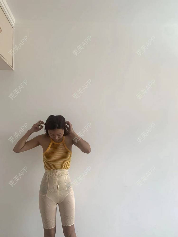更美 - 更美用户4vKb9eTt9x的射频溶脂瘦腰部经验 | 射频溶脂瘦腰部 | 射频溶脂瘦腹部
