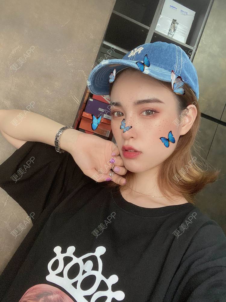 更美 - 妮0.0妮.的缩下巴经验 | 缩下巴 | 成都