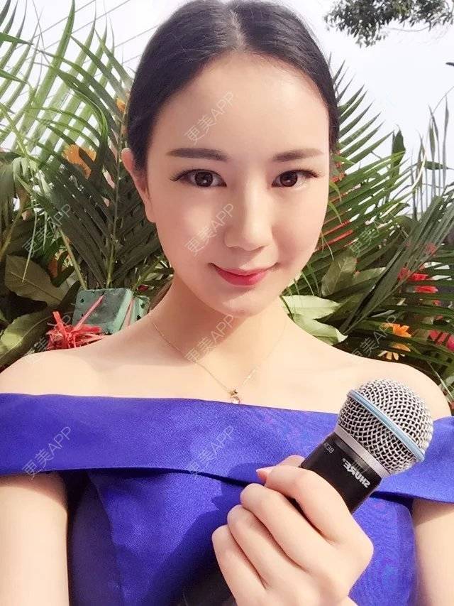 更美 - 玛丽莲.梦.露~的颧骨颧弓经验 | 颧骨颧弓 | 缩下巴 | 下颌角 | 成都 | 轮廓套餐