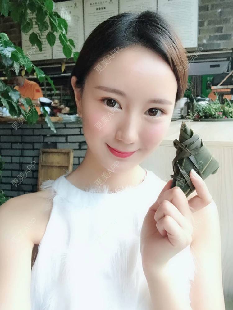 更美 - 玛丽莲.梦.露~的颧骨颧弓经验 | 颧骨颧弓 | 缩下巴 | 下颌角 | 成都 | 轮廓套餐