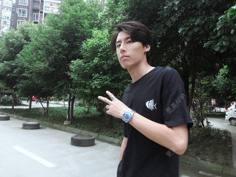 更美 - 社会你波哥~的颧骨颧弓经验 | 颧骨颧弓 | 缩下巴 | 下颌角