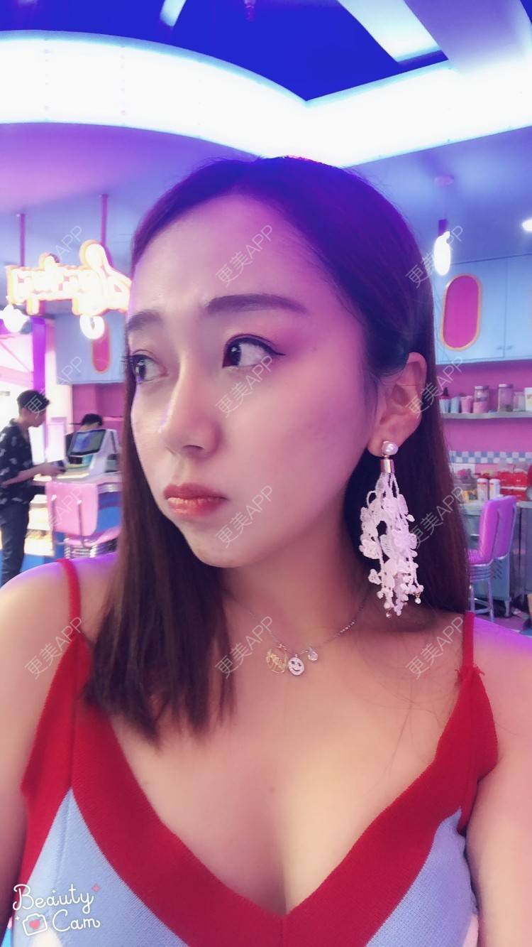 更美 - 更美用户piaDPAvn90的玻尿酸经验 | 玻尿酸全面部 | 玻尿酸眉弓 | 玻尿酸 | 深圳