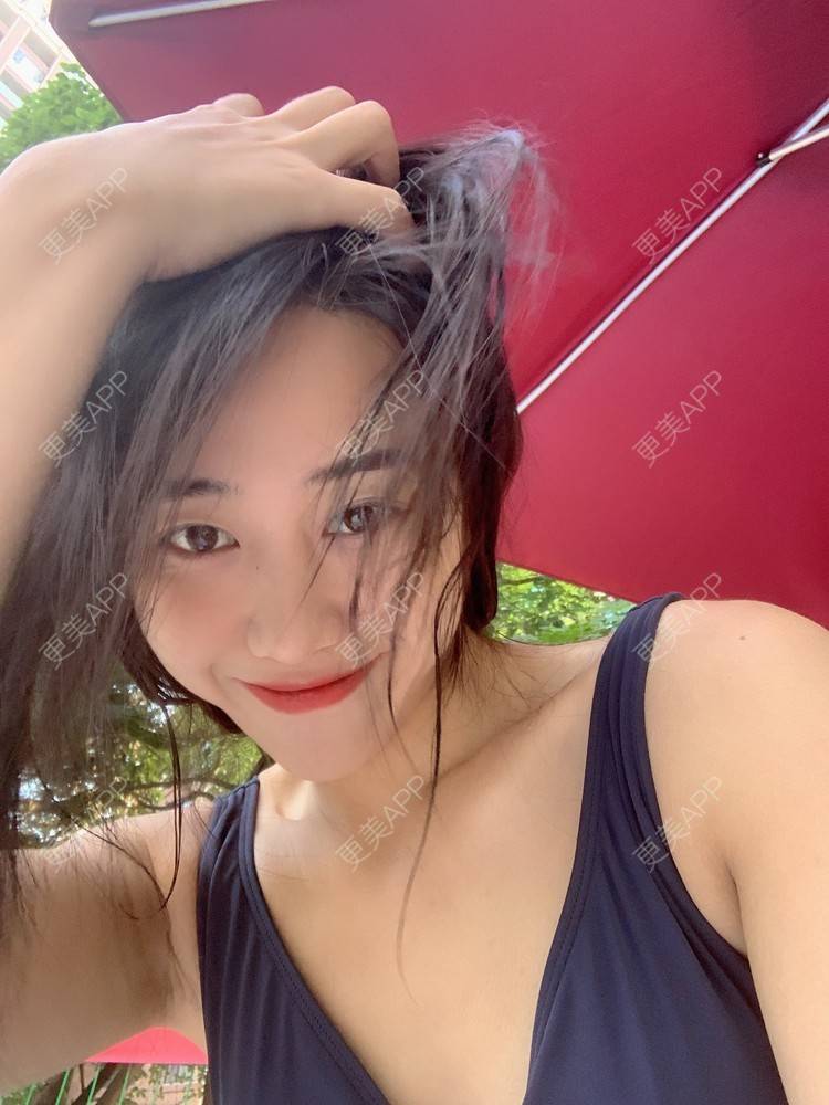 更美 - 不需要理由1.的颧骨内推经验 | 颧骨内推 | 北京 | 颧弓降低 | 全脸整形套餐 | V脸套餐 | 下颌角切除