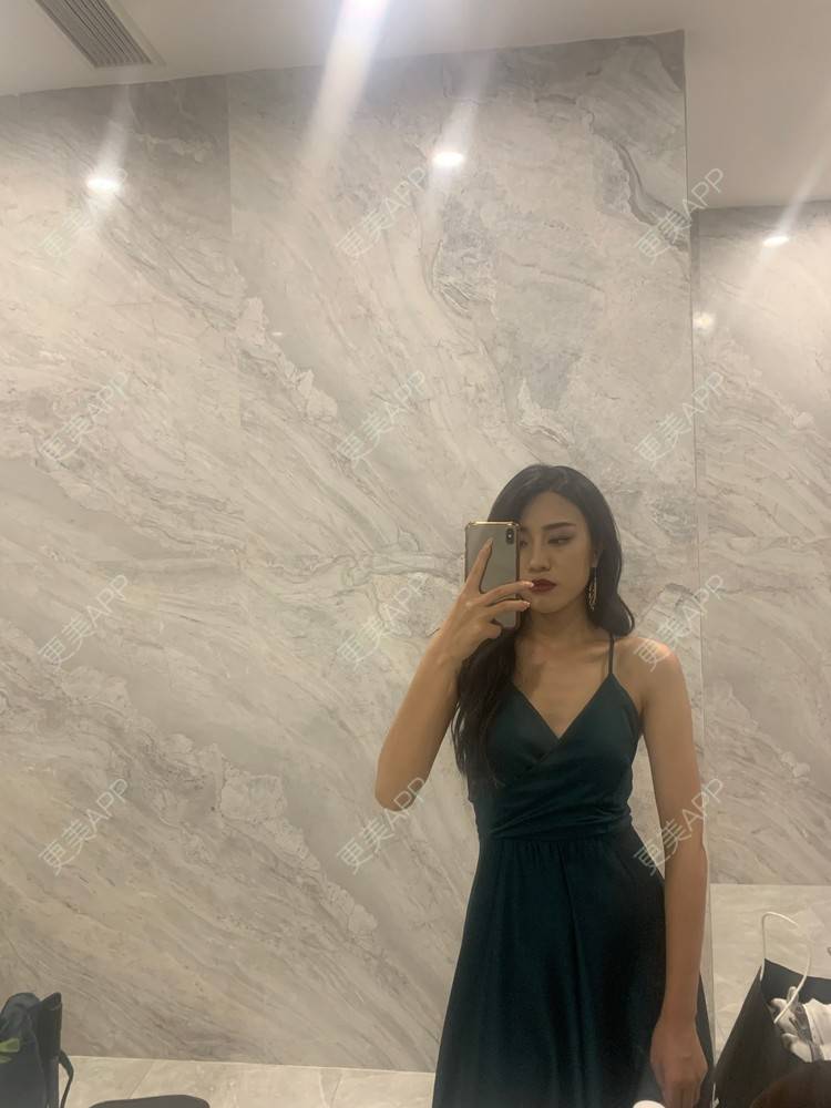 更美 - 不需要理由1.的颧骨内推经验 | 颧骨内推 | 北京 | 颧弓降低 | 全脸整形套餐 | V脸套餐 | 下颌角切除