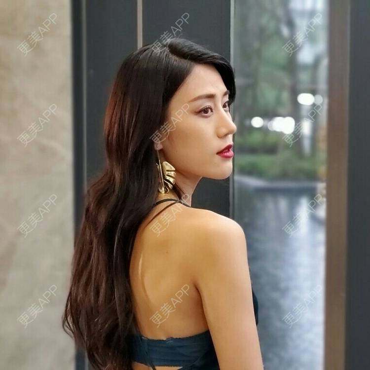 更美 - 不需要理由1.的颧骨内推经验 | 颧骨内推 | 北京 | 颧弓降低 | 全脸整形套餐 | V脸套餐 | 下颌角切除