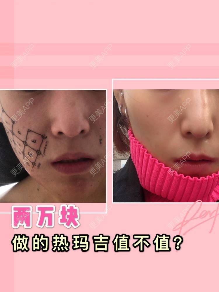 更美 - 麦可星-喵的热玛吉经验 | 热玛吉 | 大连