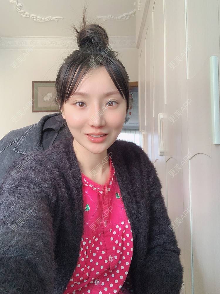 更美 - 更美用户DLi7HL09O1的人中缩短经验 | 广州 | 人中缩短