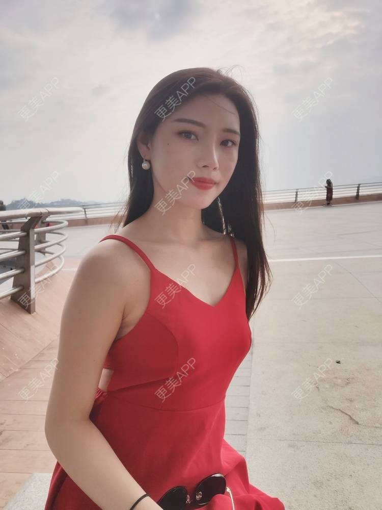 更美 - 更美用户82701801的隐形牙齿矫正经验 | 杭州