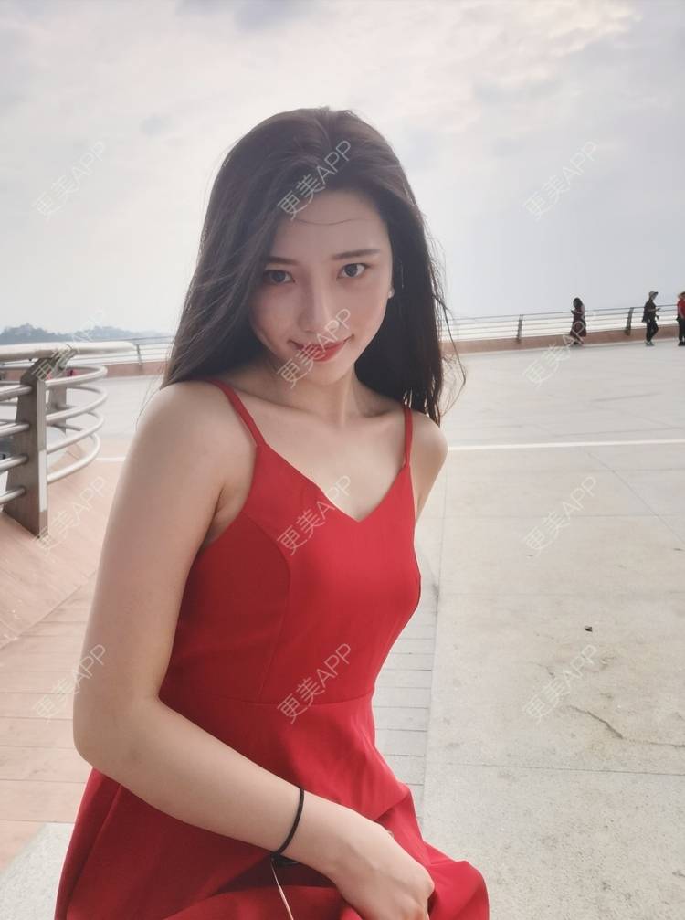 更美 - 更美用户82701801的隐形牙齿矫正经验 | 杭州