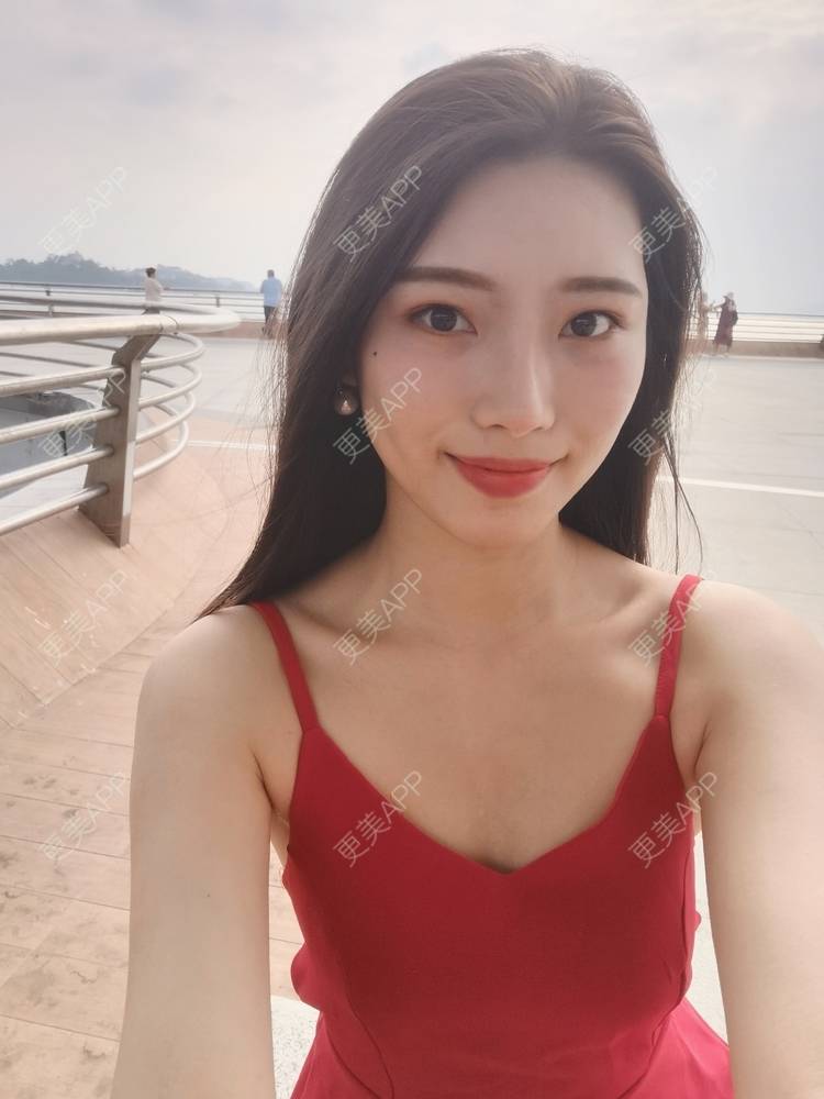 更美 - 更美用户82701801的隐形牙齿矫正经验 | 杭州