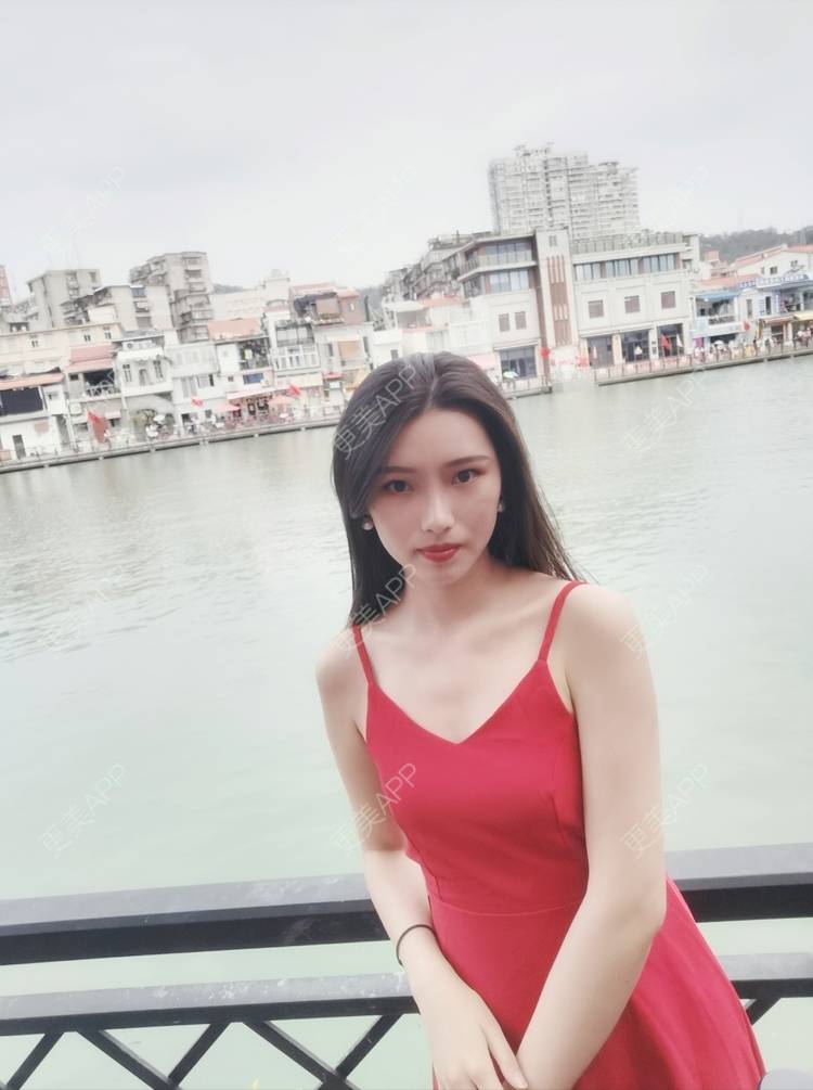 更美 - 更美用户82701801的隐形牙齿矫正经验 | 杭州