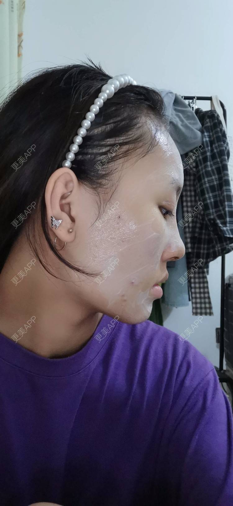 更美 - 更美用户P8Y9uWFdwL的肋软骨隆鼻经验 | 肋软骨隆鼻 | 绵阳