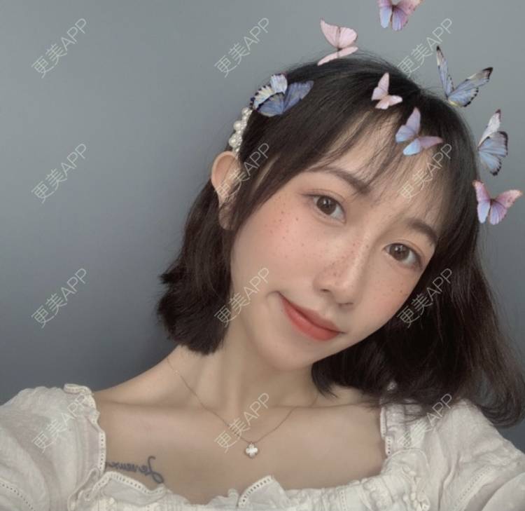 更美 - 更美用户iKgVoOKIfD的彩光嫩肤经验 | 彩光嫩肤