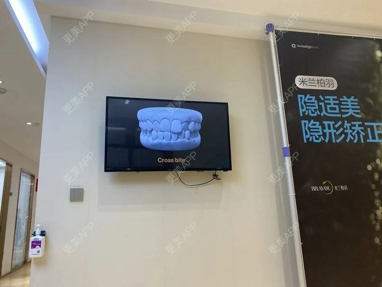 更美 - 更美用户JN0uoHTvXp的树脂补牙经验 | 西安 | 树脂补牙