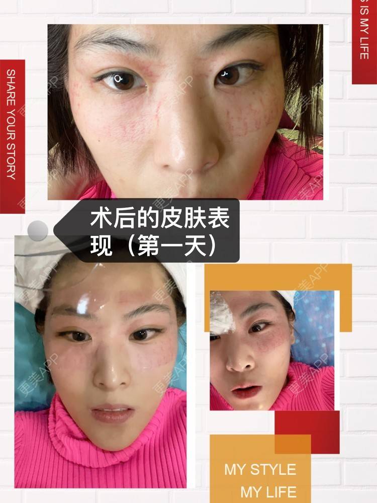 更美 - 麦可星-喵的黄金微针经验 | 黄金微针 | 大连