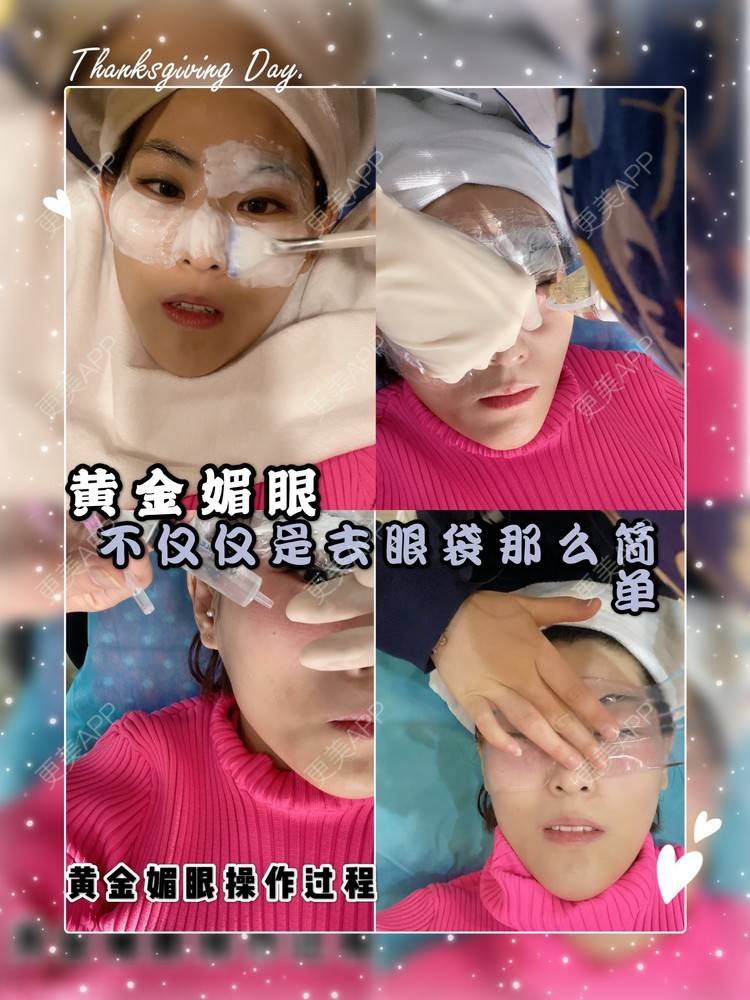 更美 - 麦可星-喵的黄金微针经验 | 黄金微针 | 大连