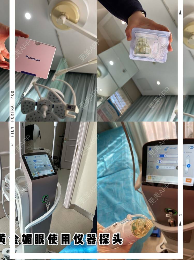 更美 - 麦可星-喵的黄金微针经验 | 黄金微针 | 大连