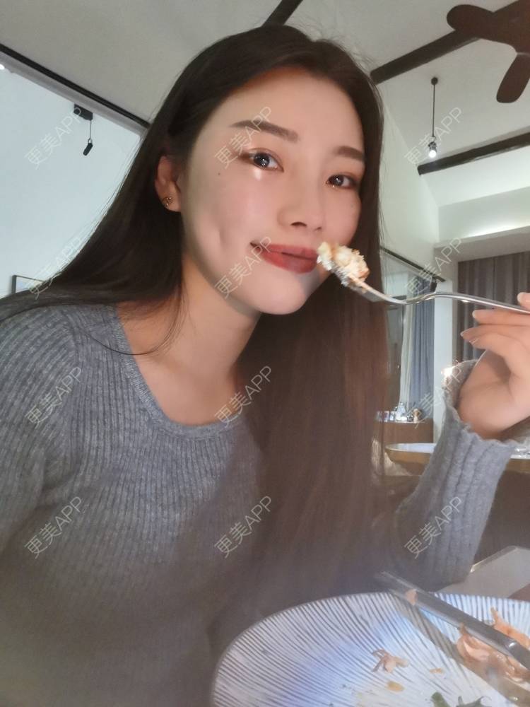 更美 - 更美用户82701801的隐形牙齿矫正经验 | 杭州