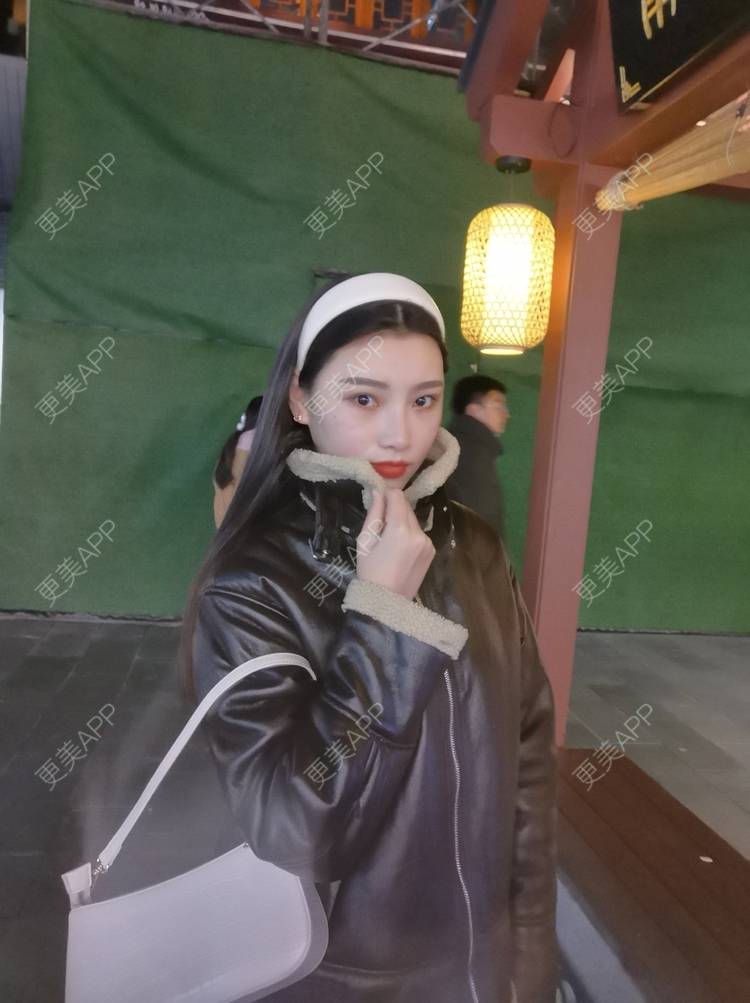 更美 - 更美用户82701801的隐形牙齿矫正经验 | 杭州