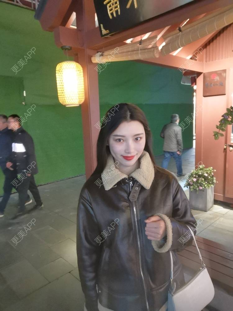 更美 - 更美用户82701801的隐形牙齿矫正经验 | 杭州